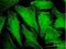 CDC42 Binding Protein Kinase Beta antibody, H00009578-M01, Novus Biologicals, Immunofluorescence image 