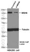 MutS Homolog 6 antibody, 18120-1-AP, Proteintech Group, Western Blot image 