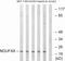 NADH:Ubiquinone Oxidoreductase Subunit A8 antibody, PA5-39269, Invitrogen Antibodies, Western Blot image 