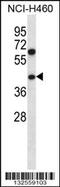 Pseudouridine Synthase 1 antibody, 56-681, ProSci, Western Blot image 
