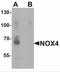 NADPH Oxidase 4 antibody, NBP2-41293, Novus Biologicals, Western Blot image 