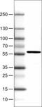 Phosphoglycerate Dehydrogenase antibody, NBP2-52939, Novus Biologicals, Western Blot image 