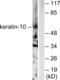 Keratin 10 antibody, abx013128, Abbexa, Western Blot image 