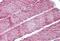 Fumarate Hydratase antibody, GTX89022, GeneTex, Immunohistochemistry paraffin image 
