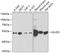 Glutamate Dehydrogenase 2 antibody, GTX33220, GeneTex, Western Blot image 