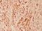 Cyclin E1 antibody, GTX66618, GeneTex, Immunohistochemistry paraffin image 