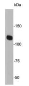 Janus Kinase 2 antibody, NBP2-66913, Novus Biologicals, Western Blot image 