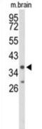 Interleukin 2 Receptor Subunit Gamma antibody, abx034377, Abbexa, Western Blot image 