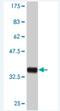 MAPK Activated Protein Kinase 3 antibody, H00007867-M04, Novus Biologicals, Western Blot image 