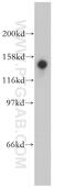 Serine/threonine-protein kinase 36 antibody, 12559-1-AP, Proteintech Group, Western Blot image 