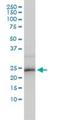 Ring Finger Protein 114 antibody, H00055905-M01, Novus Biologicals, Western Blot image 