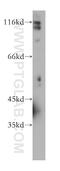 Dermatan Sulfate Epimerase antibody, 60041-1-Ig, Proteintech Group, Western Blot image 