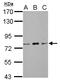 Zinc Finger And BTB Domain Containing 20 antibody, LS-C155672, Lifespan Biosciences, Western Blot image 