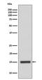 Cytochrome C, Somatic antibody, M03529-1, Boster Biological Technology, Western Blot image 