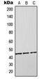 Orosomucoid 2 antibody, MBS820188, MyBioSource, Western Blot image 