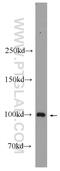 Actinin Alpha 3 (Gene/Pseudogene) antibody, 24378-1-AP, Proteintech Group, Western Blot image 