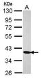Cilia And Flagella Associated Protein 410 antibody, GTX119046, GeneTex, Western Blot image 