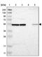 Golgi Membrane Protein 1 antibody, NBP1-88775, Novus Biologicals, Western Blot image 