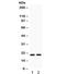 Heat Shock Protein Family B (Small) Member 2 antibody, R32240, NSJ Bioreagents, Western Blot image 