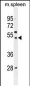 Solute Carrier Family 16 Member 13 antibody, PA5-71529, Invitrogen Antibodies, Western Blot image 