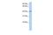 Transmembrane Protein 144 antibody, GTX46294, GeneTex, Western Blot image 