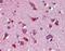 Wnt Family Member 7B antibody, A05086, Boster Biological Technology, Immunohistochemistry paraffin image 