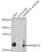 Apolipoprotein B MRNA Editing Enzyme Catalytic Subunit 3C antibody, LS-C749511, Lifespan Biosciences, Immunoprecipitation image 