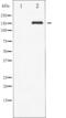 c-met antibody, abx011910, Abbexa, Western Blot image 