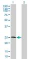 Ribonuclease A Family Member 11 (Inactive) antibody, H00122651-B01P, Novus Biologicals, Western Blot image 