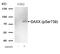 Death Domain Associated Protein antibody, GTX55302, GeneTex, Western Blot image 