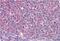 Inducible T Cell Costimulator antibody, NBP1-52139, Novus Biologicals, Immunohistochemistry paraffin image 