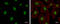 Cullin 4B antibody, GTX129298, GeneTex, Immunofluorescence image 