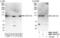 VPS50 Subunit Of EARP/GARPII Complex antibody, NBP1-78216, Novus Biologicals, Western Blot image 