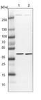 DEP Domain Containing MTOR Interacting Protein antibody, NBP1-85256, Novus Biologicals, Western Blot image 