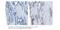 Methyltransferase Like 14 antibody, A07389-2, Boster Biological Technology, Immunohistochemistry paraffin image 