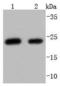 WAP Four-Disulfide Core Domain 2 antibody, A02685, Boster Biological Technology, Western Blot image 