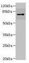 Rho Related BTB Domain Containing 1 antibody, LS-C676394, Lifespan Biosciences, Western Blot image 