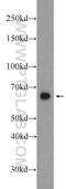 Phosphatase And Actin Regulator 1 antibody, 23446-1-AP, Proteintech Group, Western Blot image 