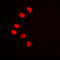 Nuclear Receptor Subfamily 2 Group F Member 2 antibody, LS-C356225, Lifespan Biosciences, Immunofluorescence image 