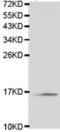 T Cell Leukemia/Lymphoma 1A antibody, TA323273, Origene, Western Blot image 