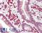 Derlin 1 antibody, LS-B9896, Lifespan Biosciences, Immunohistochemistry paraffin image 