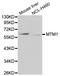 Myotubularin 1 antibody, LS-C330873, Lifespan Biosciences, Western Blot image 