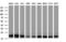 Leucine Zipper And CTNNBIP1 Domain Containing antibody, M15087, Boster Biological Technology, Western Blot image 