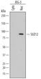 SUZ12 Polycomb Repressive Complex 2 Subunit antibody, MAB4184, R&D Systems, Western Blot image 