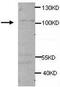 Adenylate Cyclase 9 antibody, TA310098, Origene, Western Blot image 