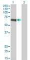 Solute Carrier Family 5 Member 2 antibody, LS-C198209, Lifespan Biosciences, Western Blot image 