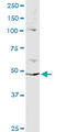 Protein Phosphatase 2 Regulatory Subunit Bbeta antibody, LS-B6417, Lifespan Biosciences, Immunoprecipitation image 