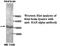 Retinoic Acid Receptor Alpha antibody, MBS415678, MyBioSource, Western Blot image 