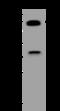 Spastin antibody, 205492-T44, Sino Biological, Western Blot image 