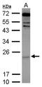 Cytoglobin antibody, LS-C155502, Lifespan Biosciences, Western Blot image 